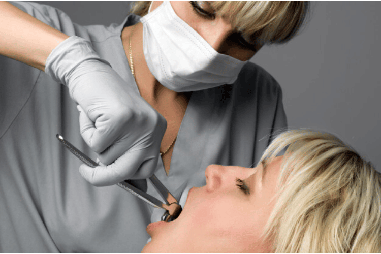 tooth extraction procedure