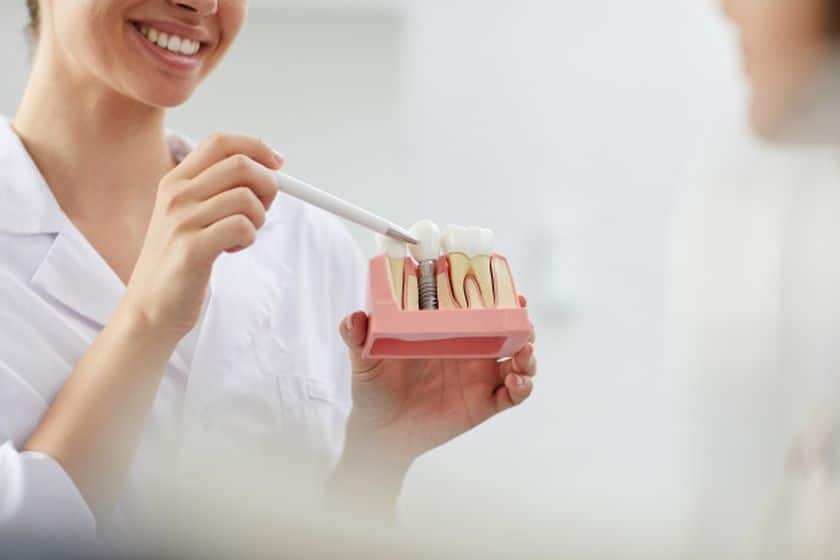 Dental Implants Cost in Sugarland TX