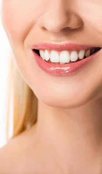 Teeth Whitening Sugar Land TX at FLOSS Dental Sugar Land