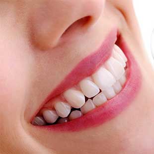Teeth Whitening in Sugar Land gives you a Vip treatment at FLOSS Dental Sugar Land