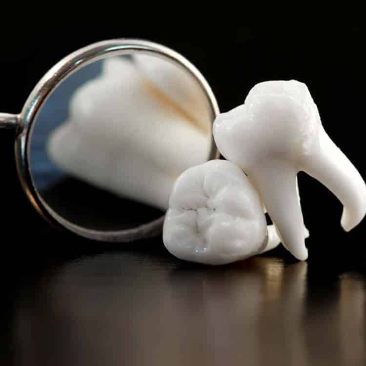Tooth Extraction Sugar Land TX at FLOSS Dental Sugar Land