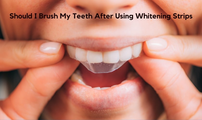 Should I Brush My Teeth After Using Whitening Strips